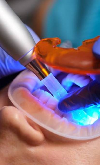 Curing light being used to harden a tooth-colored filling