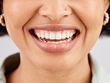 Close-up of woman’s smile with healthy teeth and gums